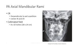 Radiographic Positioning of the Mandible [upl. by Arvy]