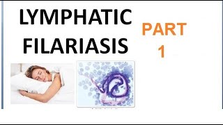 Parasitology 221 a Wuchereria Bancrofti Filariasis Filarial worm Elephantiasis Culex Microfilaria [upl. by Juliet]