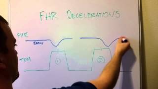 Fetal Heart Rate Decelerations Early Late Variable [upl. by Ecnarual]