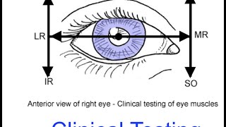 11 Ocular motility exam [upl. by Oliver235]