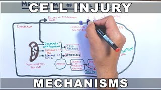 Mechanisms of Cell Injury [upl. by Conger]