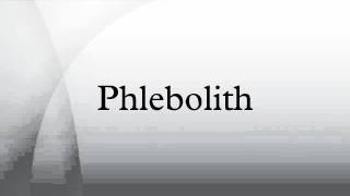 Phlebolith [upl. by Eugirne]