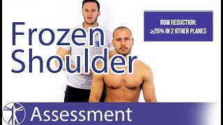 How to diagnose Frozen Shoulder  Frozen Shoulder [upl. by Schertz]