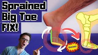 Stubbed Toe or Broken Toe Symptoms Pain Relief amp Treatment [upl. by Pan]