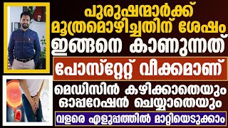 പ്രോസ്റ്റേറ്റ് വീക്കംമെഡിസിൻ കഴിക്കാതെയുംഓപ്പറേഷൻ ചെയ്യാതെയും വളരെ എളുപ്പത്തിൽ മാറ്റിയെടുക്കാം [upl. by Anej]