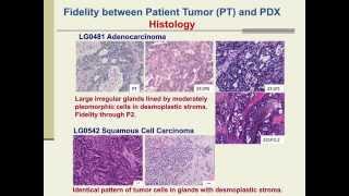 PatientDerived Xenografts for Cancer Therapeutics Development and Predictive Modeling [upl. by Adnil]