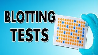 Blotting Techniques Western Blot Southern Blot and Northern Blot [upl. by Rossuck43]