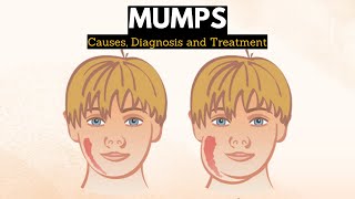 Measles Causes Signs and Symptoms Diagnosis and Treatment [upl. by Mali888]