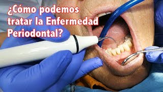 Enfermedad Periodontal II ¿Cómo podemos tratar la enfermedad periodontal [upl. by Atinus44]