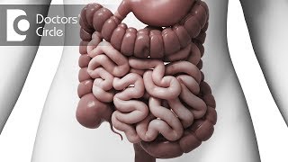 What is Intussusception in adults  Dr Nagaraj B Puttaswamy [upl. by Wiebmer]