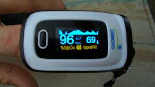 Pulse Oximeter with Atrial Fibrillation Display [upl. by Aiselad961]