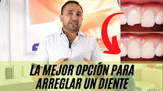 ¿Qué es mejor para dientes frontales CARILLAS ó RESINA [upl. by Norved738]