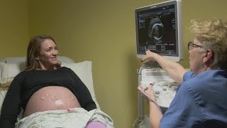 Ultrasounds during pregnancy [upl. by Enineg612]