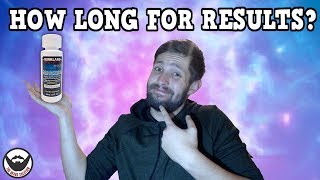 quotHow Long Before I See Resultsquot  Minoxidil Beards  BeardTalk  Ep 4 [upl. by Vogel]