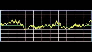 AntiAging  Rife Frequencies [upl. by Wilmer]