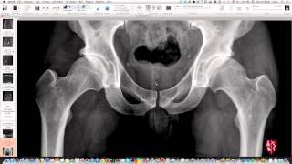 Pelvis and Hips Essential Radiography Repost [upl. by Bowers]