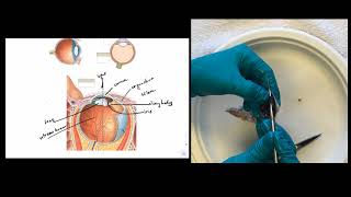 Eye Dissection Instructions [upl. by Medorra]