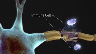 Shoulder Kinesiology Glenohumeral Joint Movement [upl. by Thadeus166]