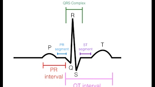 EKGECG Interpretation Basic  Easy and Simple [upl. by Heilman]