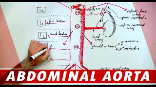 Abdominal Aortic Aneurysm AAA Ultrasound [upl. by Musette5]