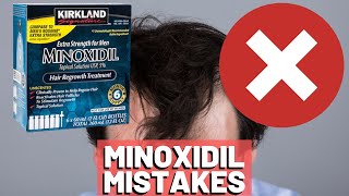 5 BIGGEST MISTAKES When Using Minoxidil REVEALED [upl. by Hgielra]