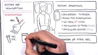 Diabetic Ketoacidosis Diabetes Type I Management Summary [upl. by Bamford814]