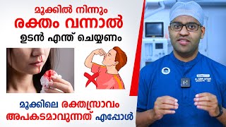 മൂക്കിലെ രക്തസ്രാവം അപകടമാവുന്നത് എപ്പോൾ  Epistaxis Malayalam  Arogyam [upl. by Athallia]