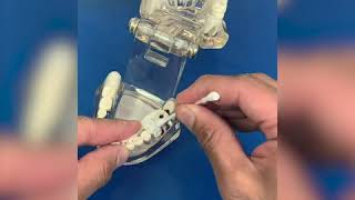 How to use temporary dental filling material [upl. by Enrobyalc452]