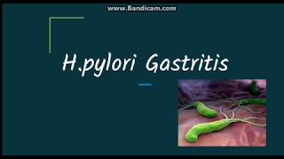 Helicobacter pylori gastritis Pathogenesis and morphology [upl. by Ramos673]