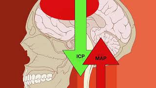 Cerebral Perfusion Pressure [upl. by Ann-Marie412]