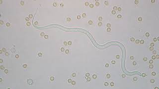 Dirofilaria immitis  microfilaria [upl. by Erroll]