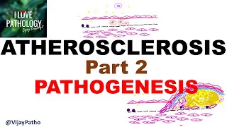 ATHEROSCLEROSIS  Part 2 Pathogenesis [upl. by Enahc]