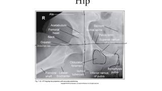 Hip and pelvis image evaluation [upl. by Repsaj]