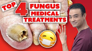 4 MEDICAL treatments to get rid of toenail fungus  Holistic Toenail Fungus Cures Part 3  Dr Kim [upl. by Araek20]