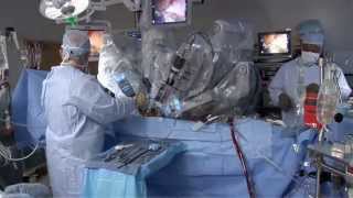 Laparoscopic vs Robotic [upl. by Lari969]