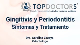 Gingivitis y Periodontitis Síntomas y Tratamiento [upl. by Rexanna481]