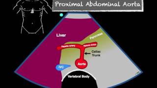 Abdominal XRays Made Easy [upl. by Chlori800]