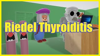 Riedel Thyroiditis Mnemonic for the USMLE [upl. by Dean418]