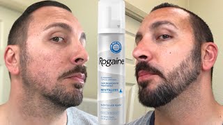 How to grow a REAL Beard  Minoxidil 4 Month Beard Journey [upl. by Kristal]