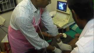 intussusception by Dr K M Abul Hasan [upl. by Ahsekram]