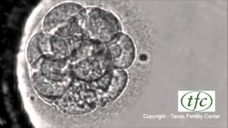 Human Embryo Growing from Fertilization to Day 6 Blastocyst [upl. by Kirt]