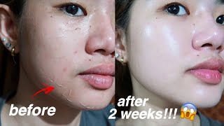 KOREAN SKIN IS REAL😱 I TRIED REJUVINATING SET FOR 2 WEEKS AND THIS IS WHAT HAPPENED [upl. by Lahcym720]