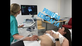 PRIMERA ECOGRAFÍA 🤰🏻 12 SEMANAS DE EMBARAZO [upl. by Rhys]