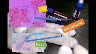 Microfilaria live and dead under Microscope [upl. by Reggie]