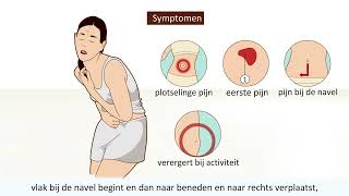 Blindedarmontsteking  Symptomen en operatie [upl. by Nevin]