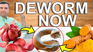 DEWORM NOW  How to Parasite Cleanse at Home  Home Remedies That Cleanse And Detoxify Your Colon [upl. by Esiouqrut]