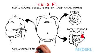 Abdominal Distension The 6 Fs that can help your diagnosis [upl. by Neetsirhc]