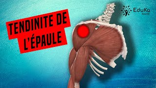 COMPRENDRE LA TENDINITE DE LÉPAULE Explications professionelles [upl. by Arhat949]