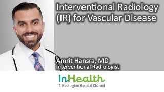 Interventional Radiology IR for Vascular Disease [upl. by Ahsienyt]