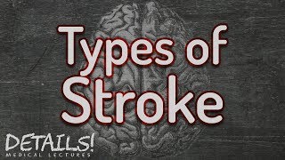 Types of Ischaemic Stroke  Oxford Bamford Classification  Details [upl. by Ponton]